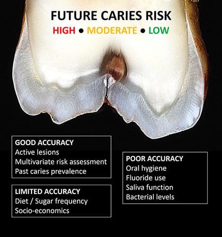 Future caries risk